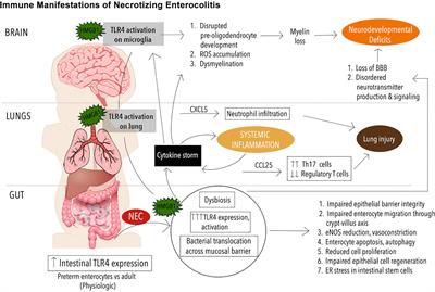 Prenatal Immunity and Influences on Necrotizing Enterocolitis and Associated Neonatal Disorders